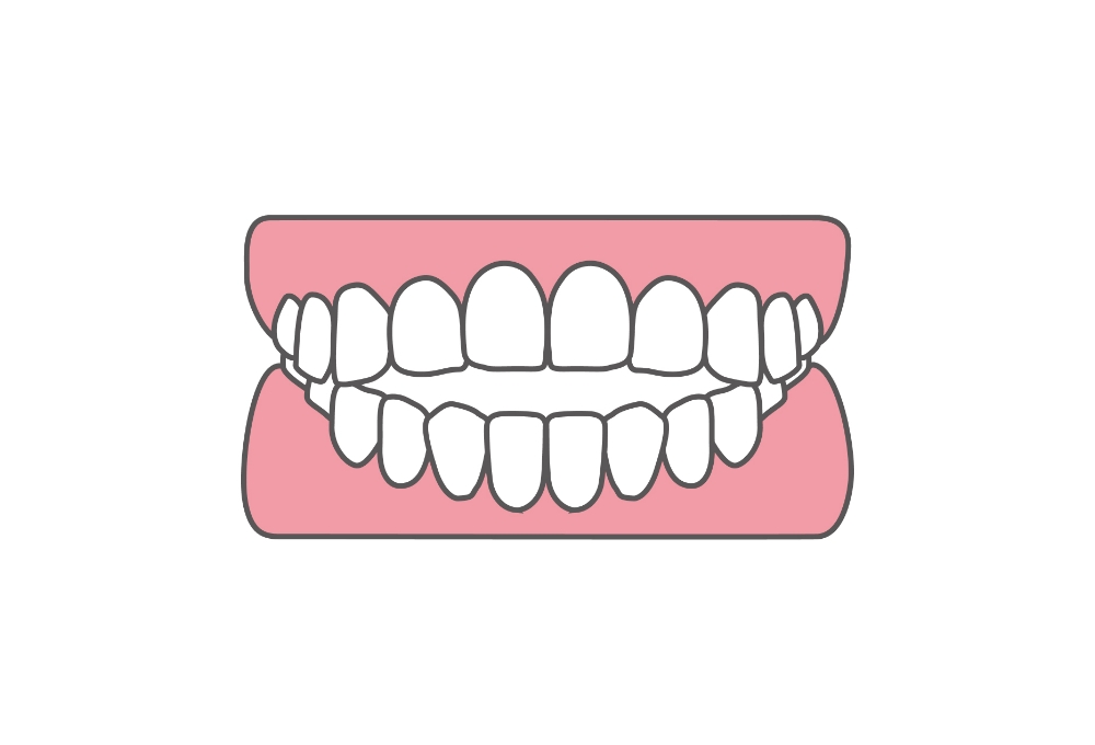 開咬(かいこう)